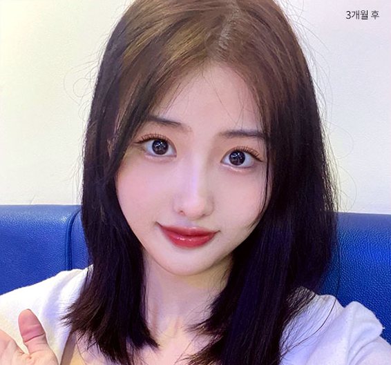 Real 사례 1 After(3개월 후)