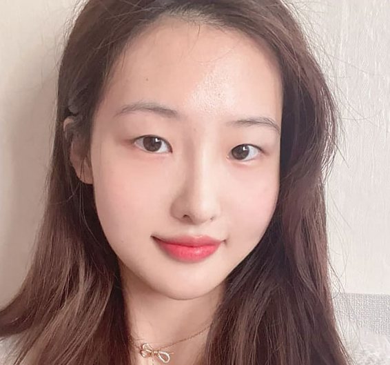 Real 사례 1 Before
