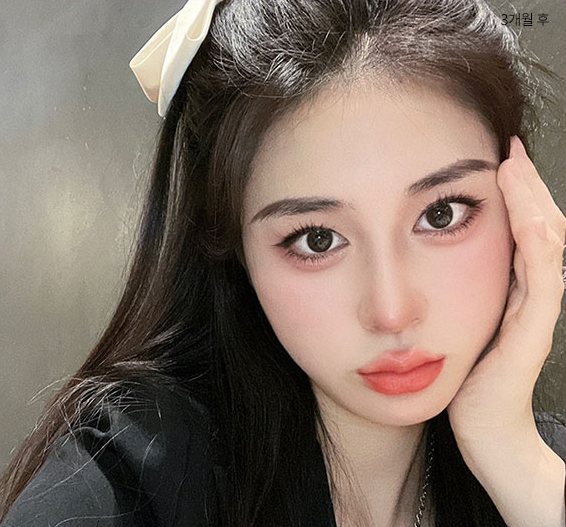 Real 사례 2 After(3개월 후)
