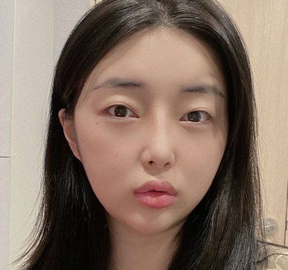 Real 사례 4 Before