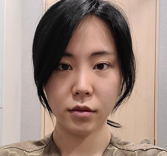 Real 사례 5 Before