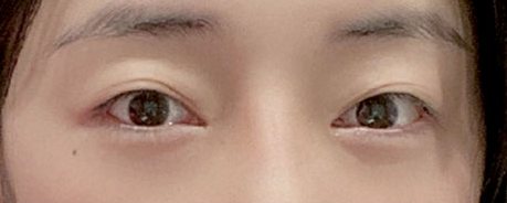 리얼모델 2 눈 BEFORE