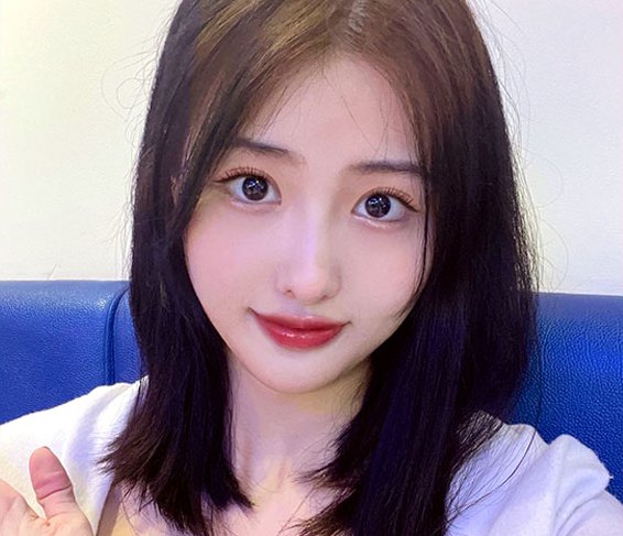 Real 사례 1 After(3개월 후)