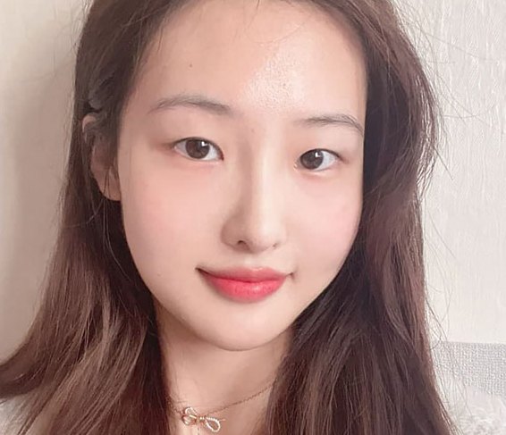 Real 사례 1 Before