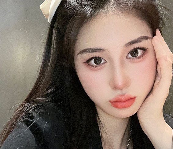 Real 사례 2 After(3개월 후)
