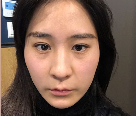 Real 사례 2 Before