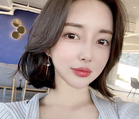 Real 사례 4 After(3개월 후)