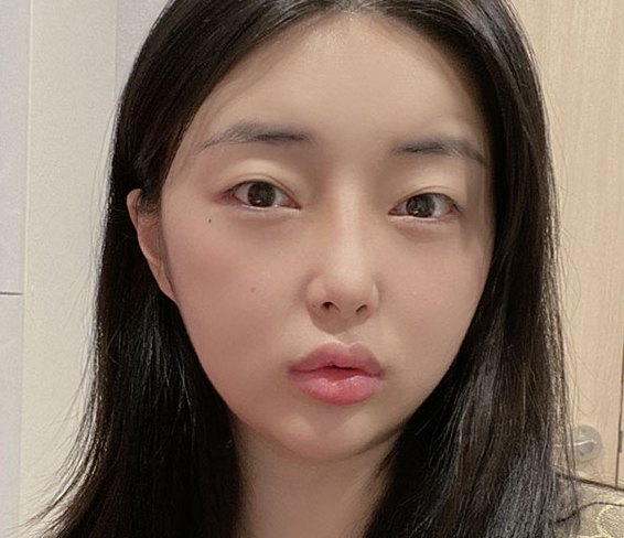 Real 사례 4 Before