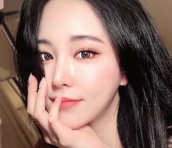 Real 사례 5 After(3개월 후)