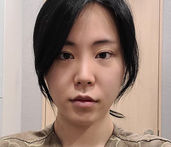 Real 사례 5 Before
